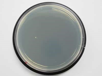 no microbial growth